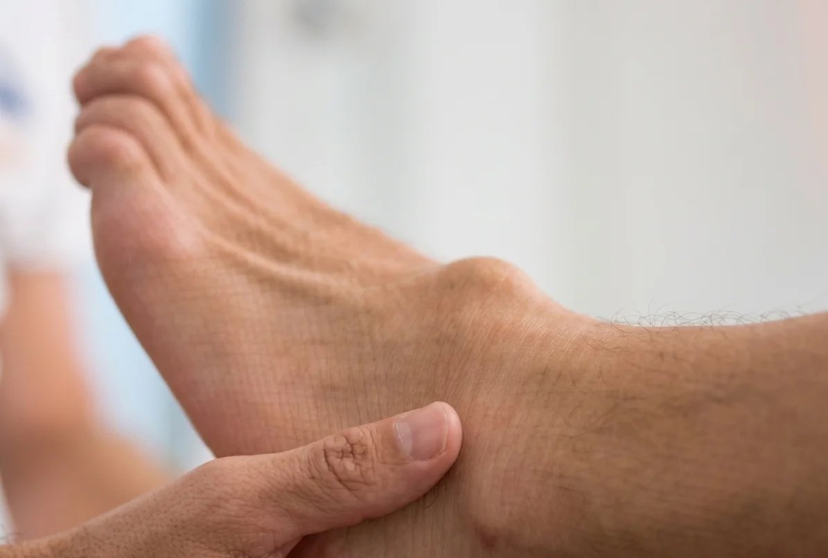 Rafa's foot